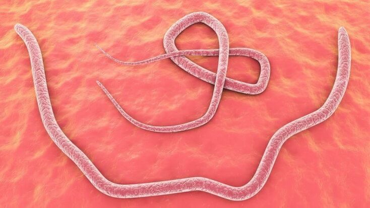 roundworms dina awak manusa