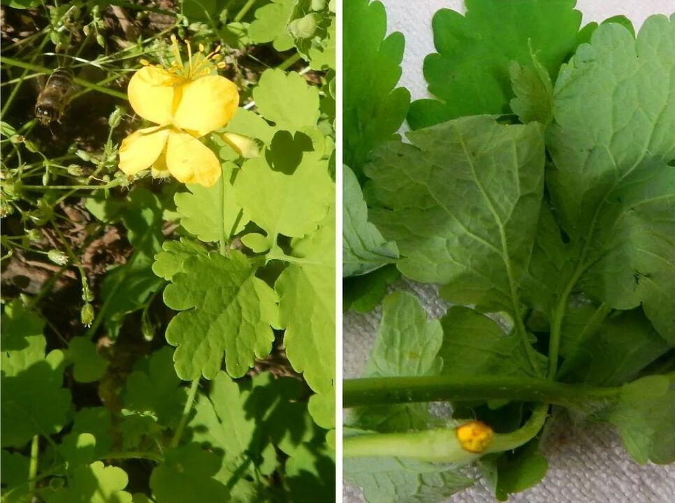 celandine ngalawan parasit