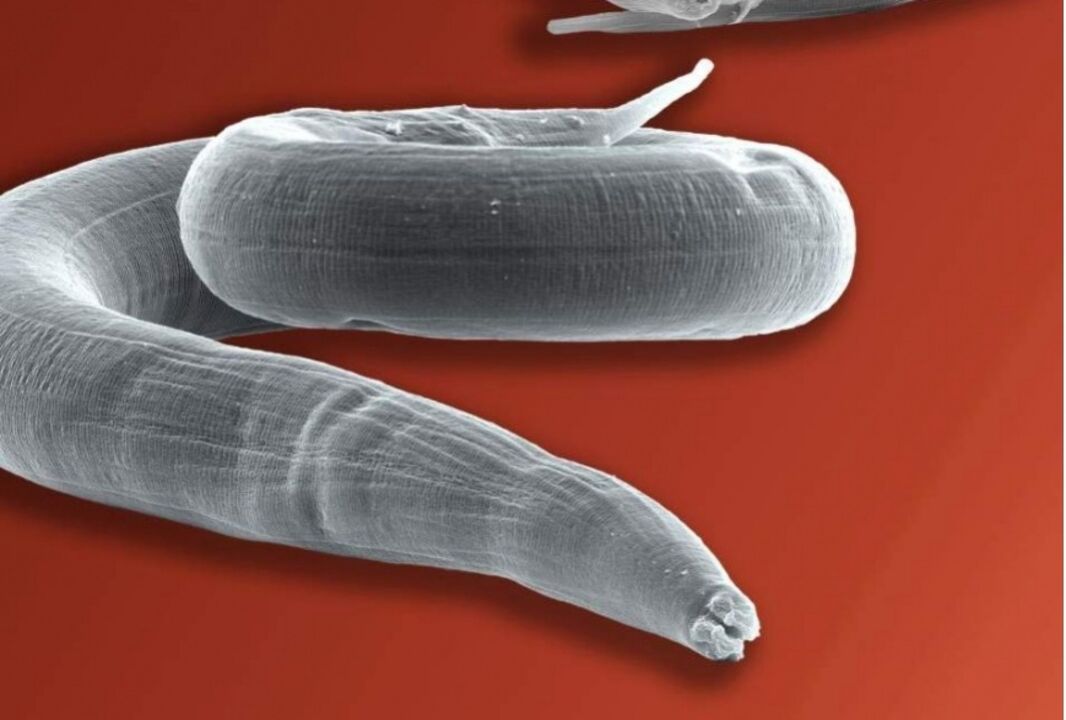 pinworm tina awak manusa